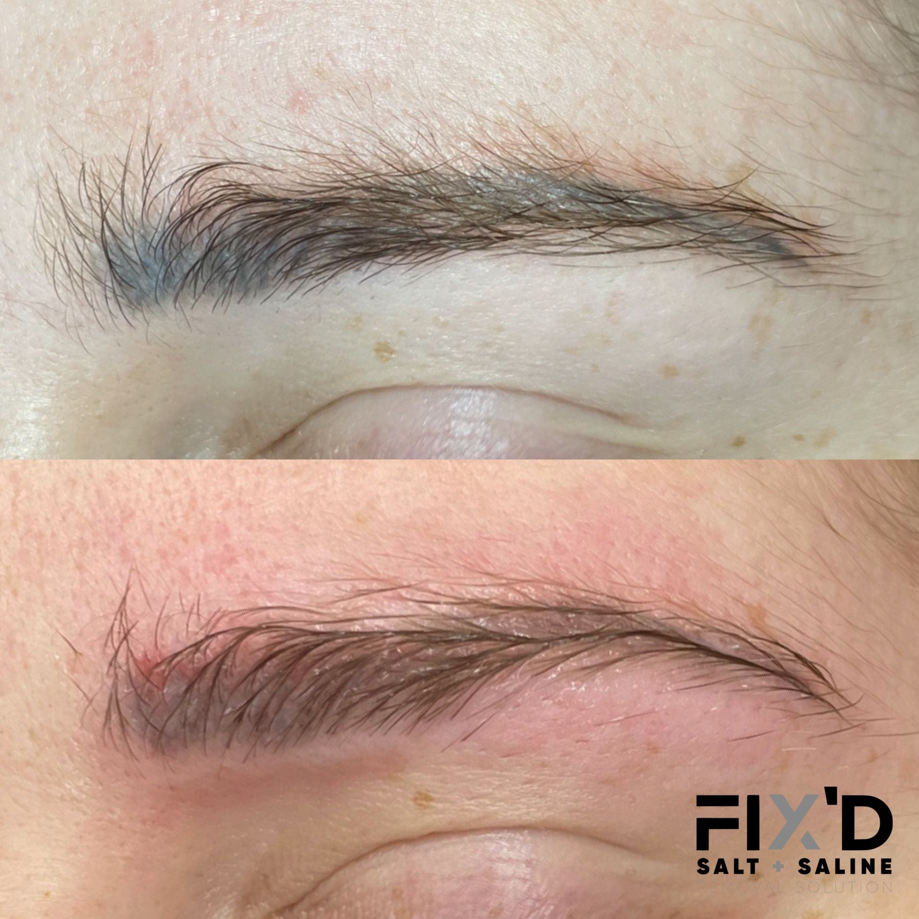 Sel et solution saline FIX'D